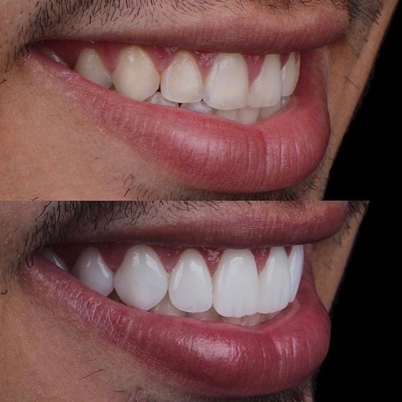 Alejandro Angelo López Díaz-7