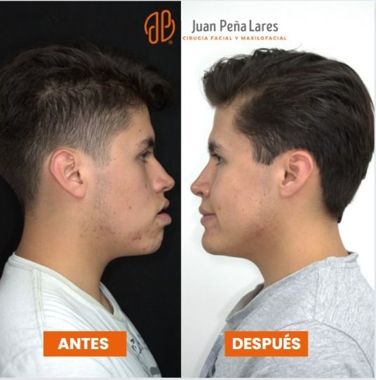 Juan Peña Lares-14