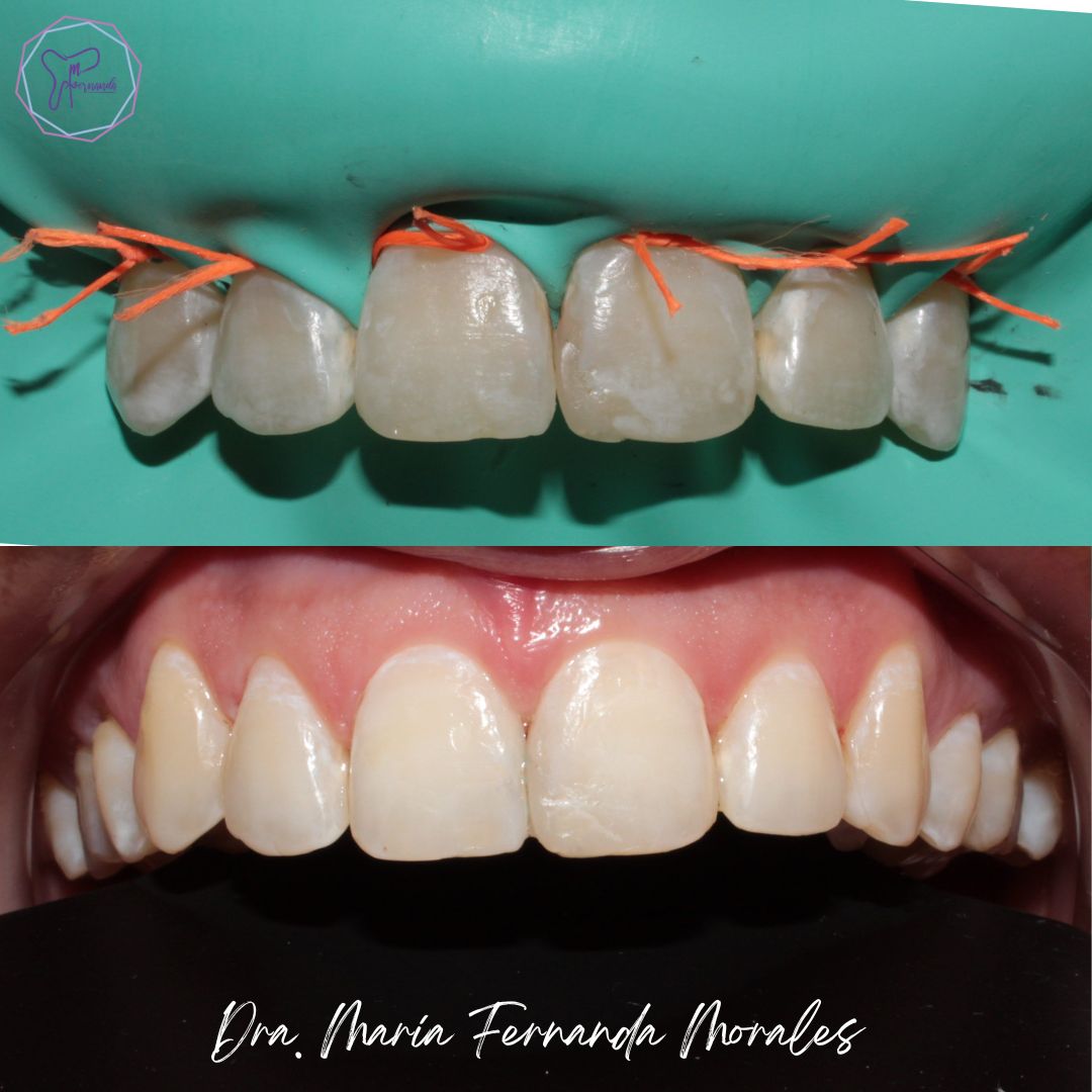 Maria Fernanda Morales Hernandez-6