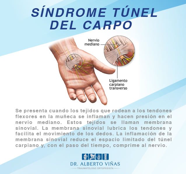 Alberto Viñas Silva-32