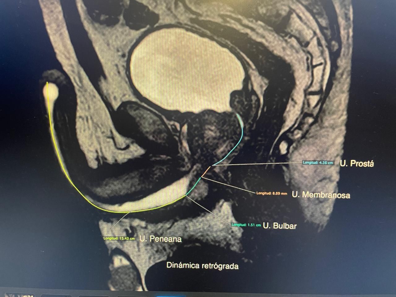 Marco Antonio Hernández Merino-1