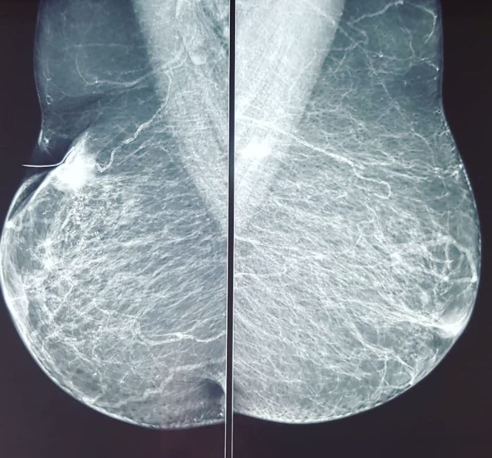 Daniel Alejandro Cantu Pedroza-6