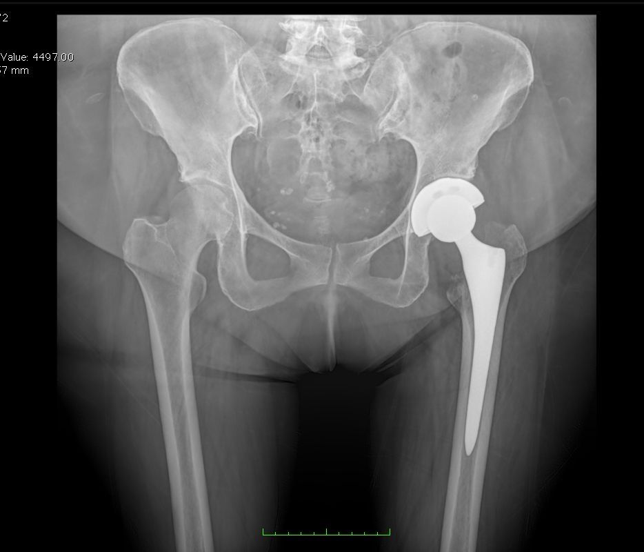 Josué Jonatan Arcia Guzmán-18