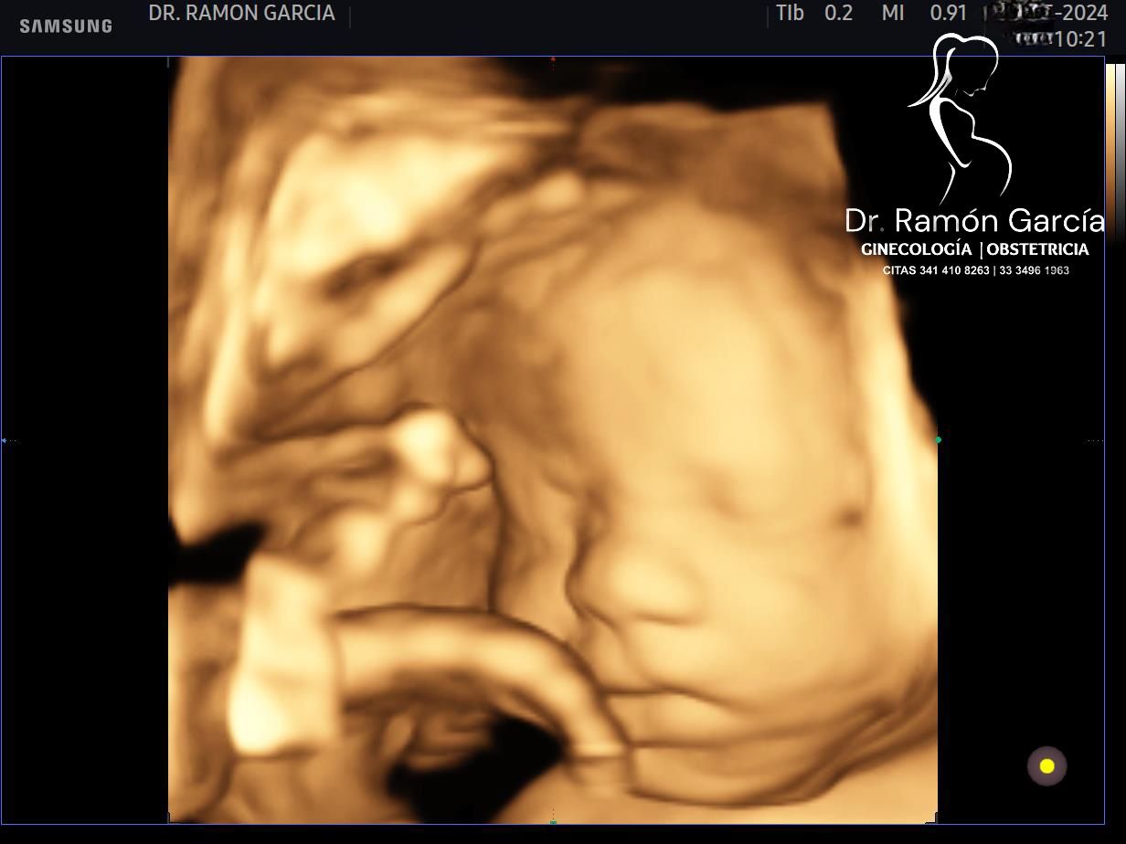 Ramon García Flores-3