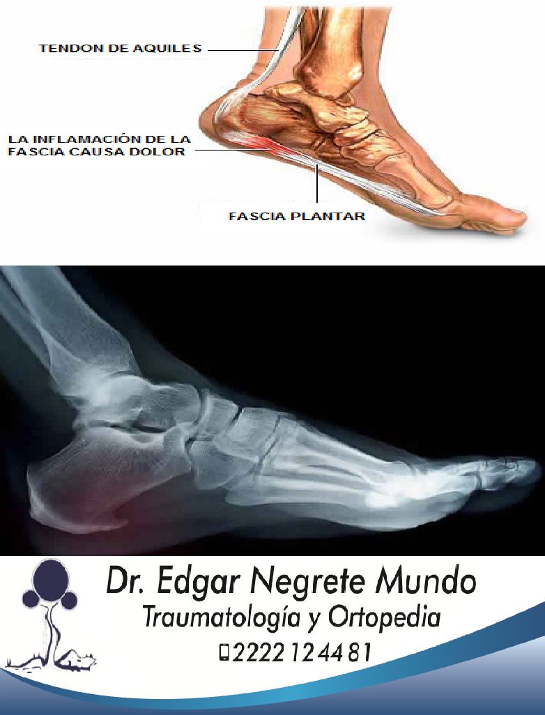 Edgar Negrete Mundo-2