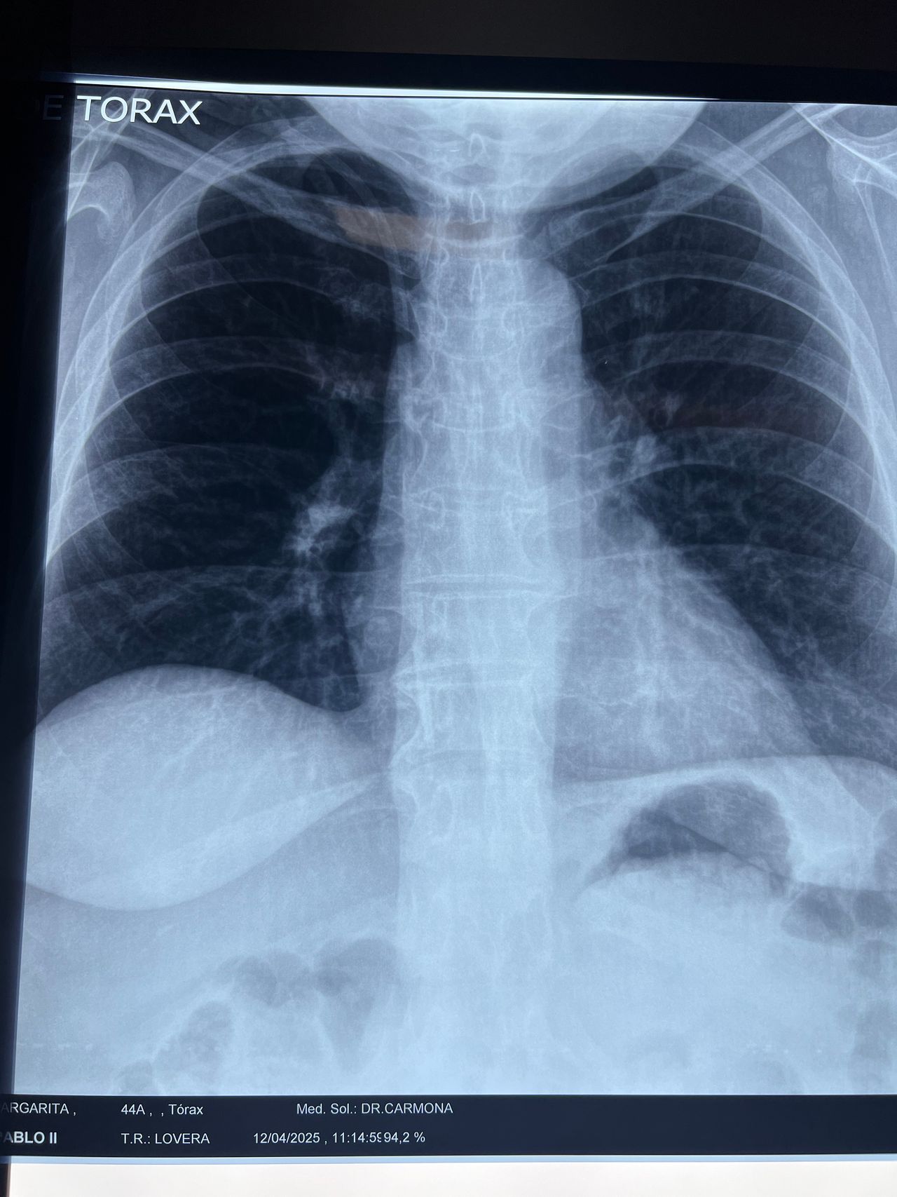 Carlos Andrés Carmona Bautista-6