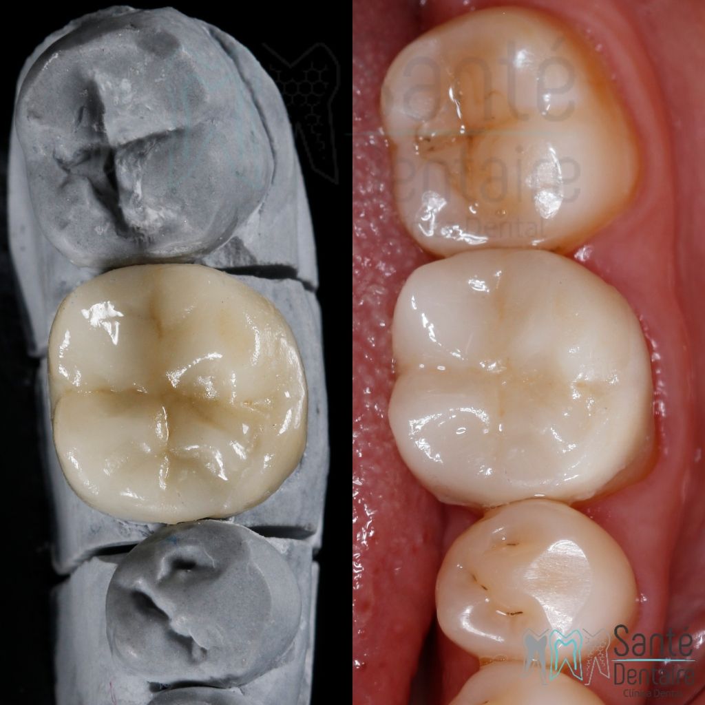 Daniel Oñate Robledo-35