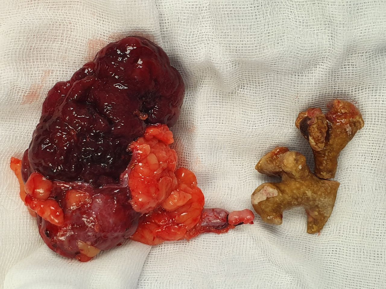 Víctor Hugo Tapia Romero-1