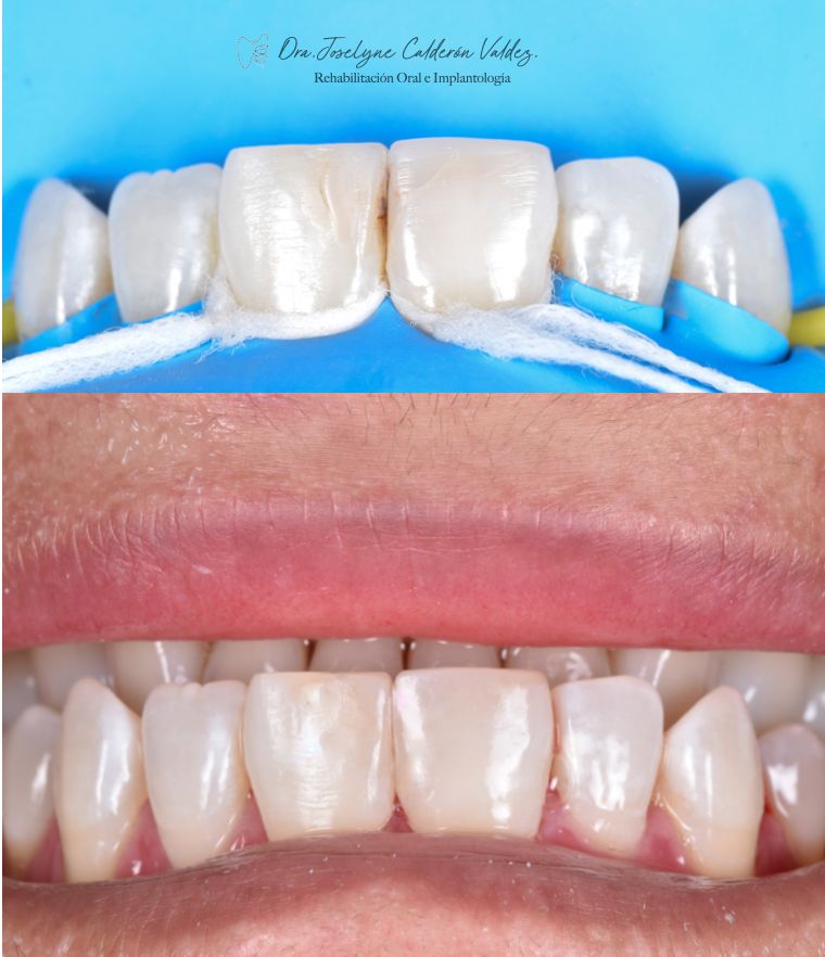 Joselyne Calderón Valdez-4