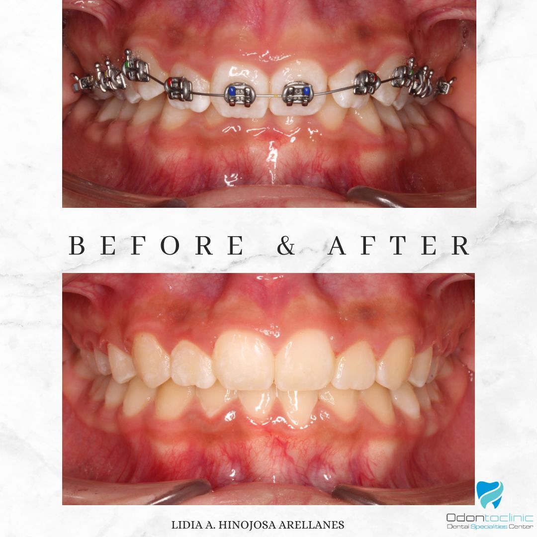 Lidia Abigail Hinojosa Arellanes-16