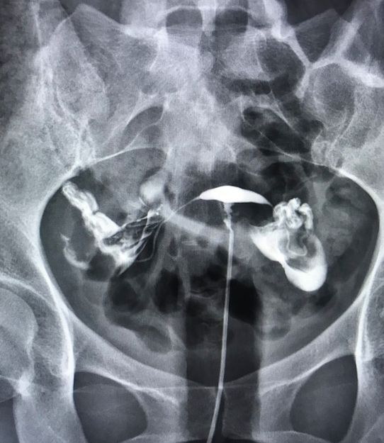 Griselda Reyes Torres-104