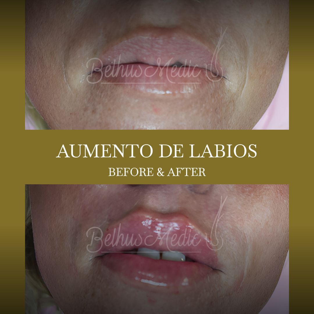 Alejandra Soriano Elorza-88