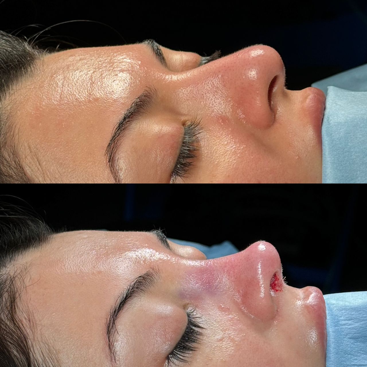 Angel Castro Urquizo-92