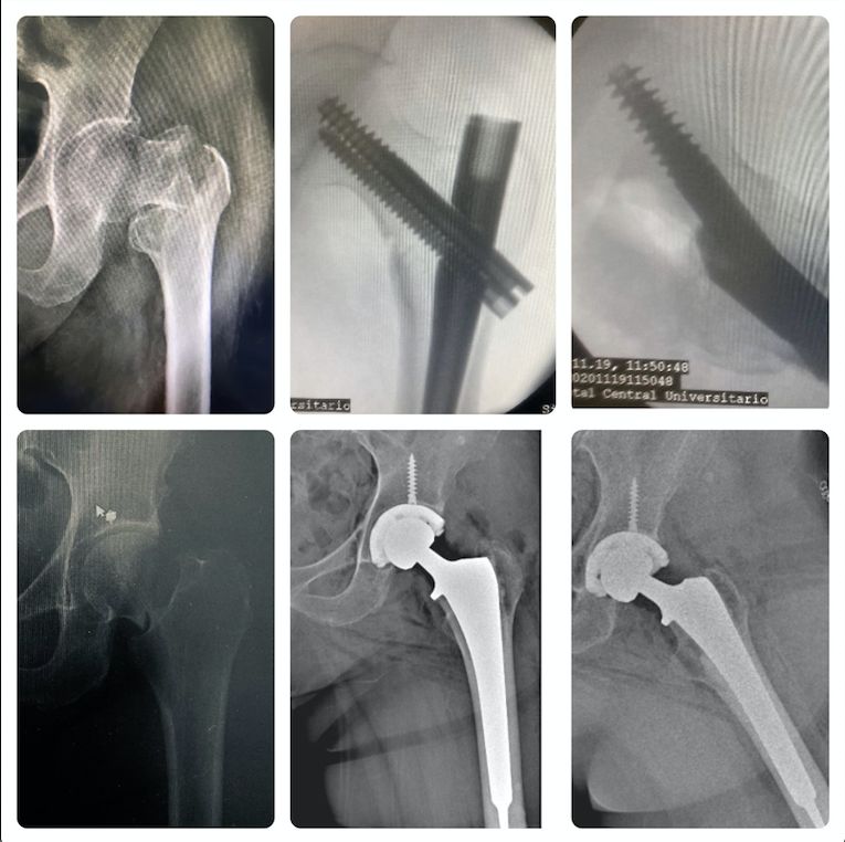 Luis Iram Lozano Parra-8
