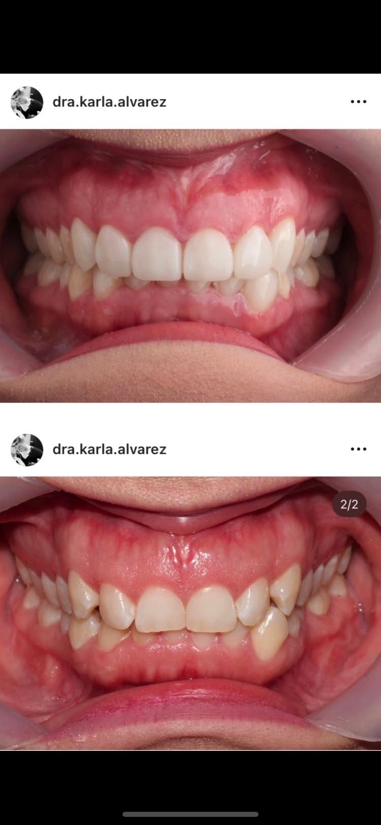 Karla Alvarez Treviño-2