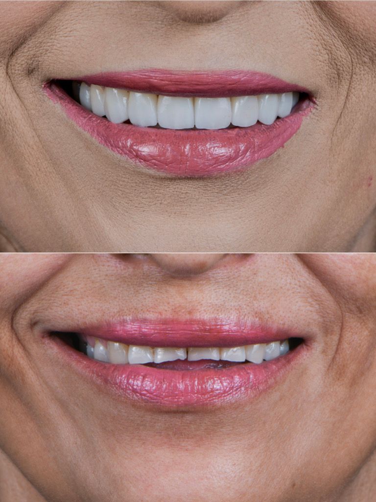 Ricardo López Lemus-96