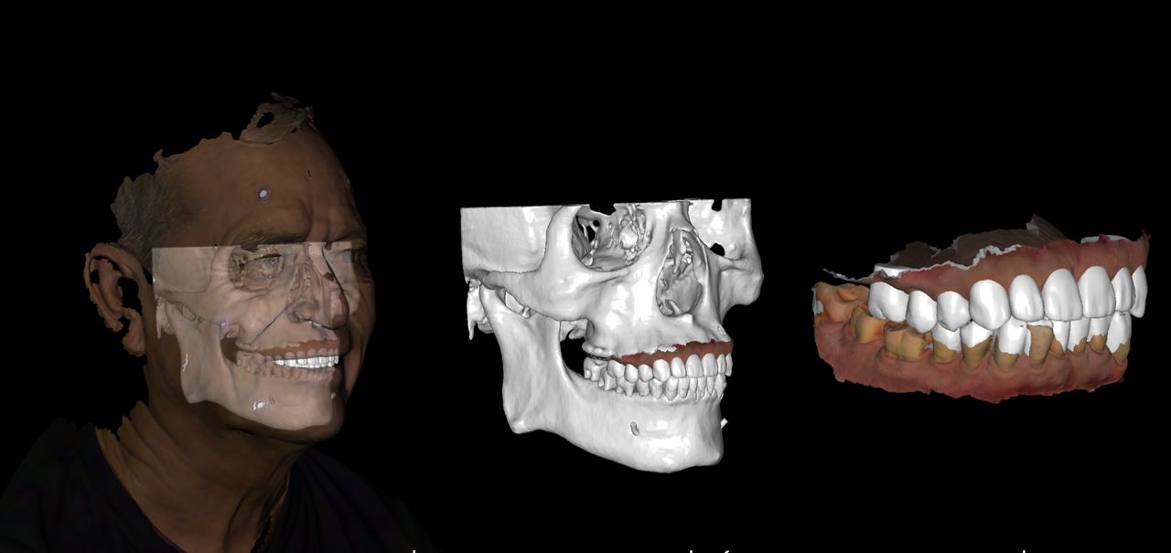 Alexandro Castrellon-10