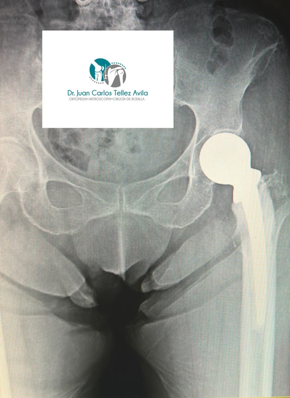 Juan Carlos Tellez Avila-3