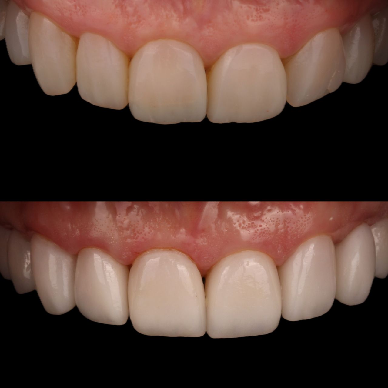 Miguel Alberto Escalona Mora-5