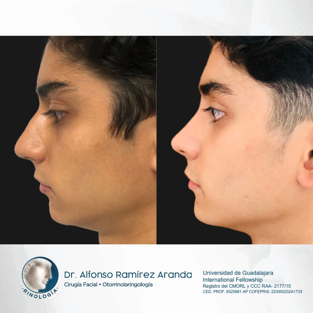 Alfonso Ramírez Aranda-17