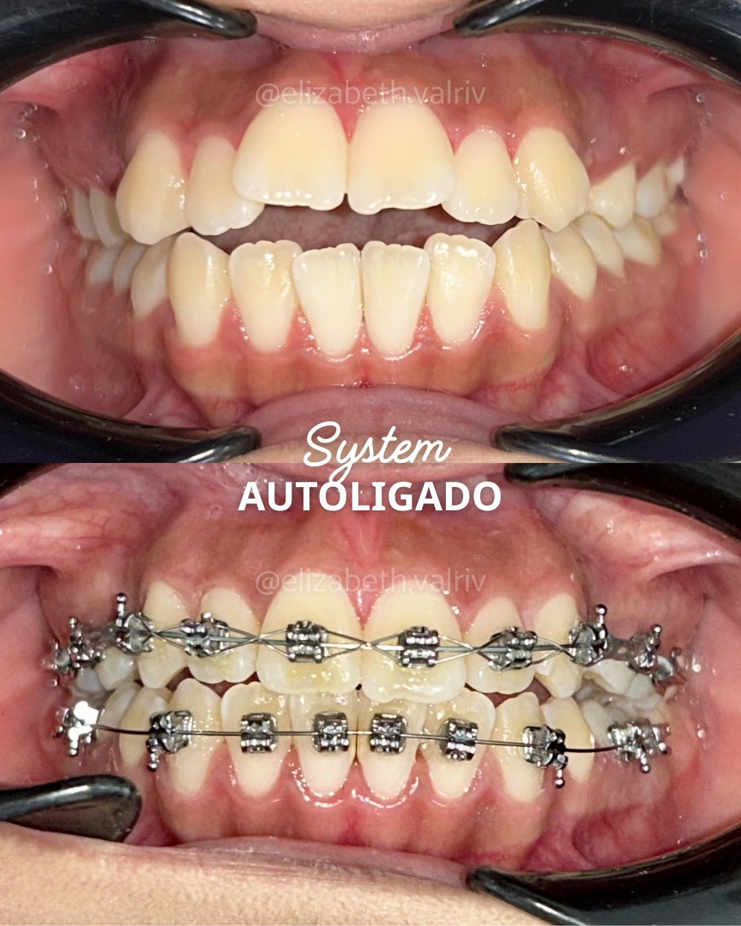 Elizabeth Valenzuela Rivera-7