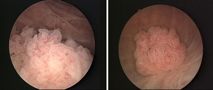 Javier Lazcano Hernández-3