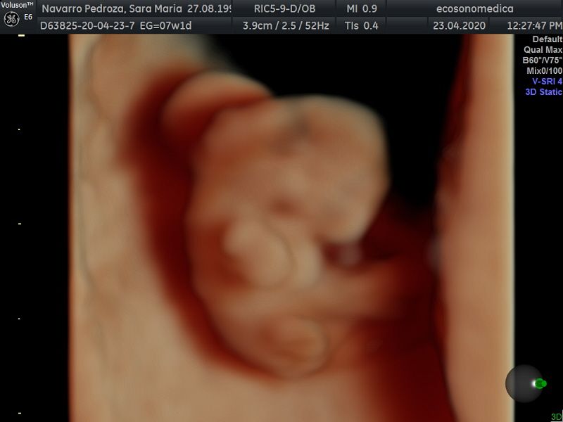 Héctor Bernardo Acevedo Manrique-23