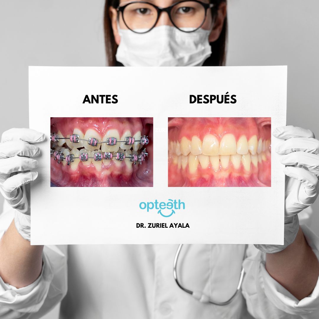 Zuriel Ayala Garcia-6