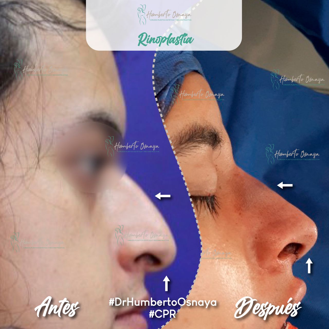 Humberto Osnaya Moreno-35