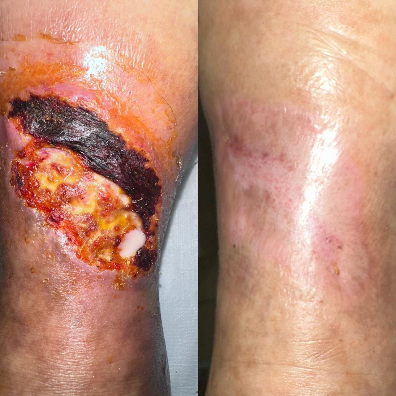 Jhonatan López González-62