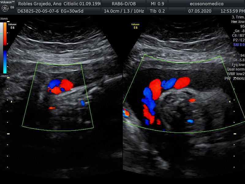 Héctor Bernardo Acevedo Manrique-14