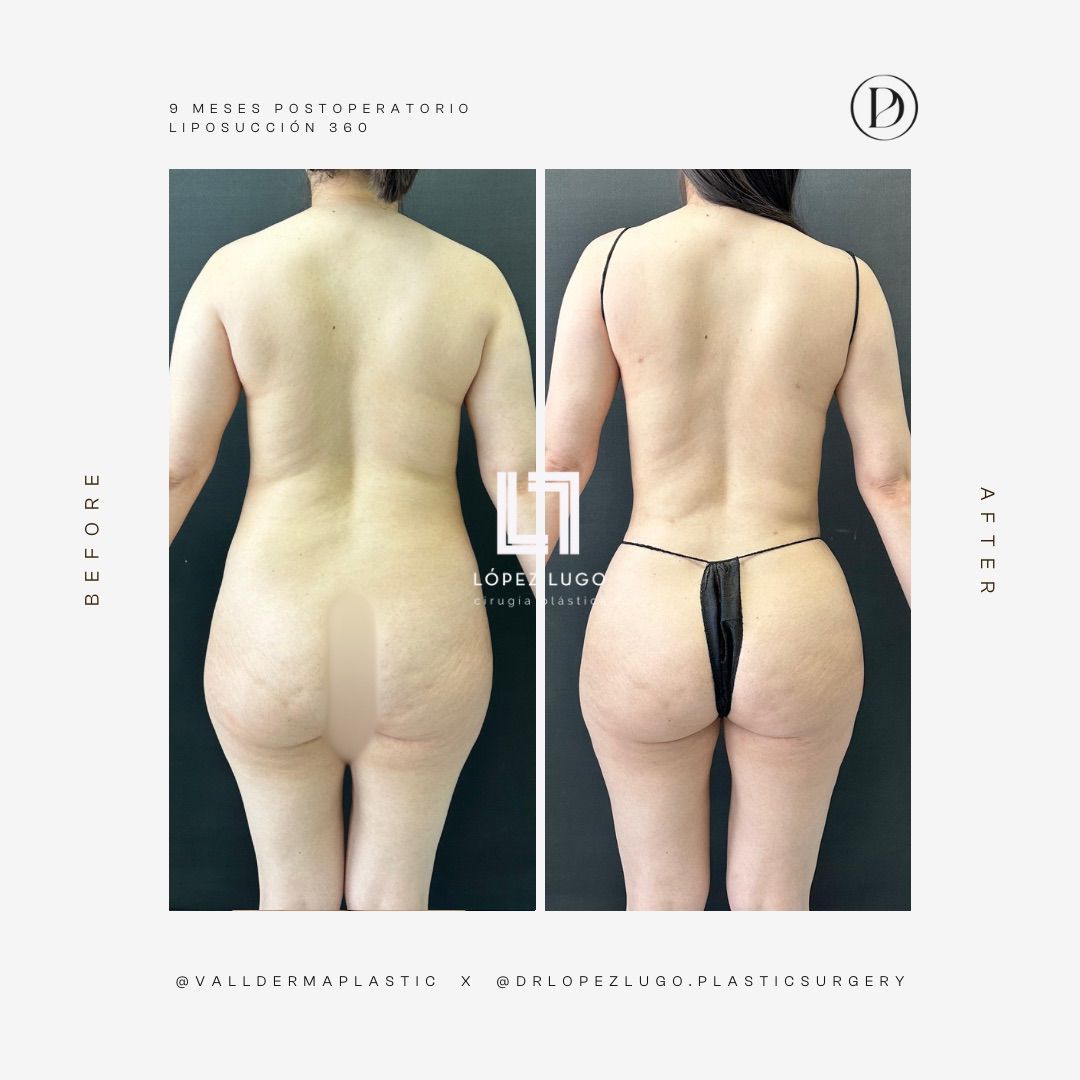 Omar Federico López Lugo-17