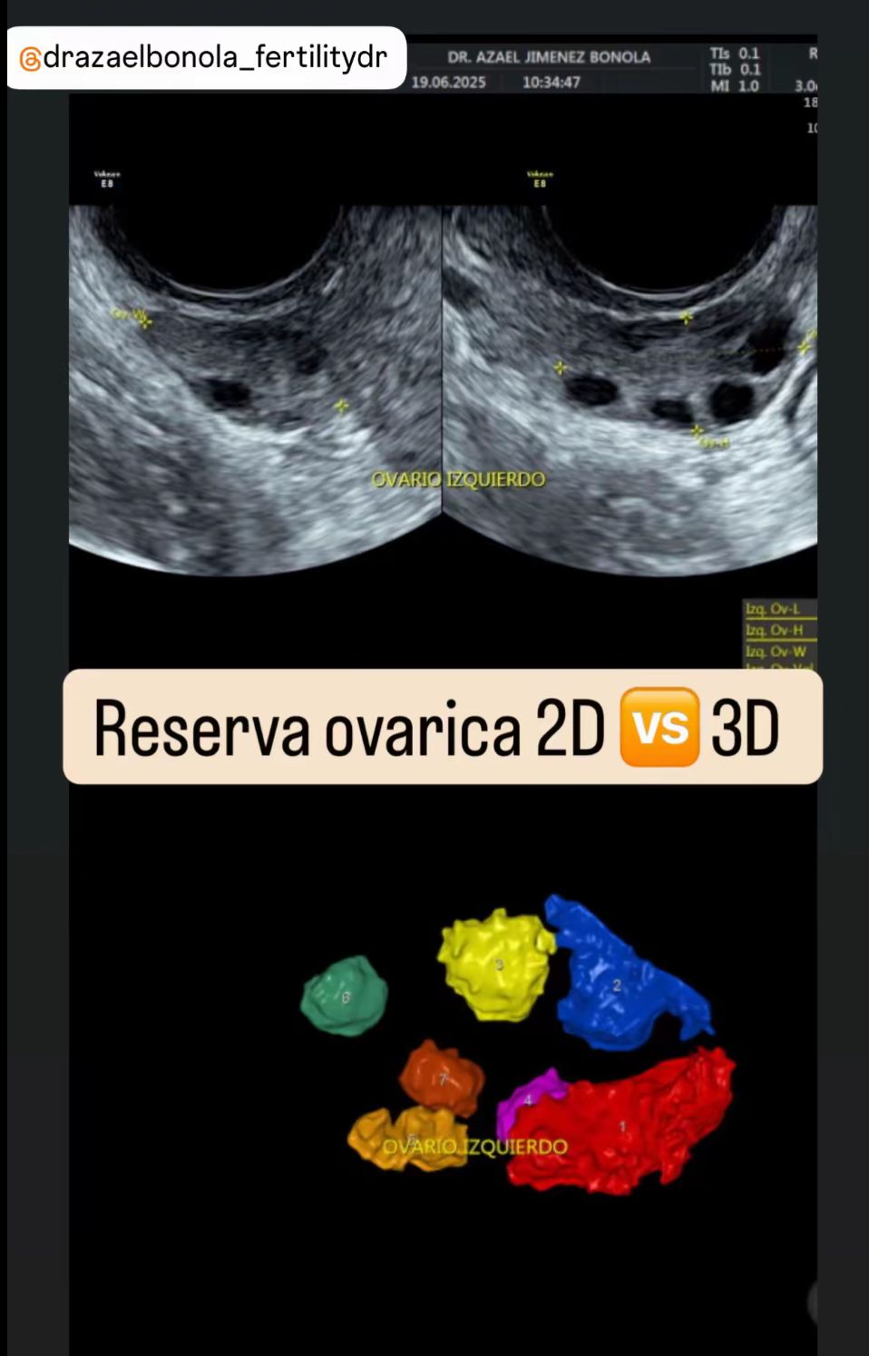 Azael Jiménez Bonola-10