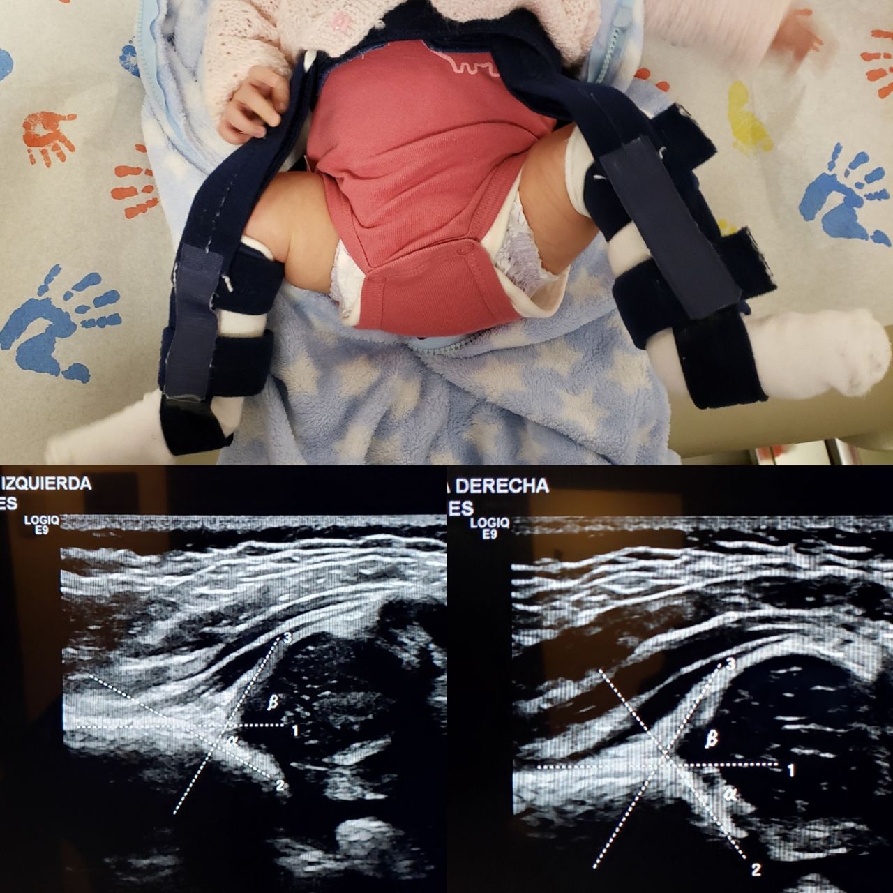 Alfonso Meza Vernis-87