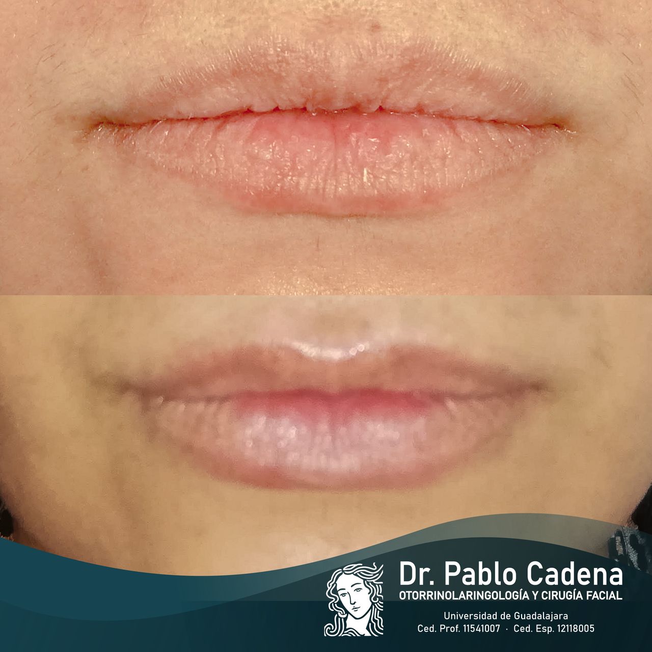 Juan Pablo Cadena Calderón-14