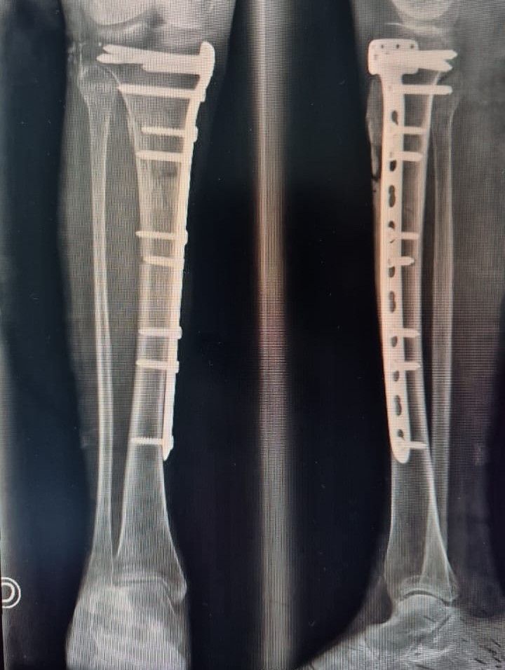 Donovan Cantillo De Lucio-2