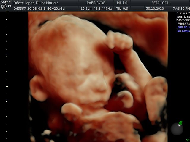 Arturo Herrera Flores-13