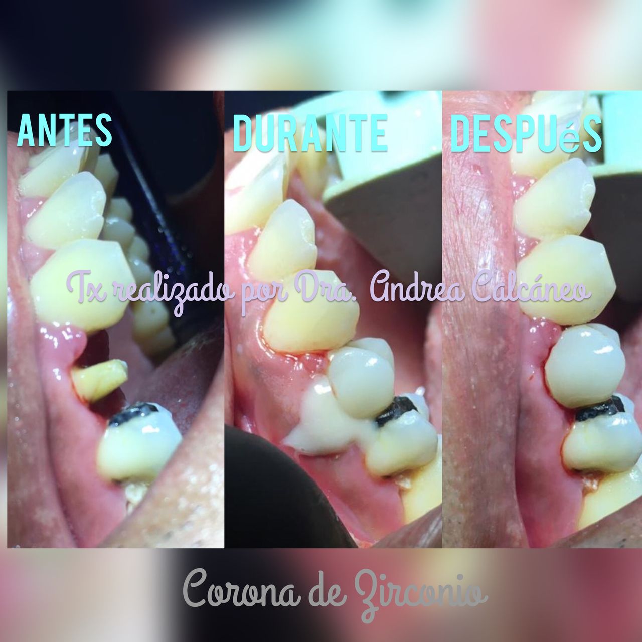 Andrea Calcáneo Castañeda-5