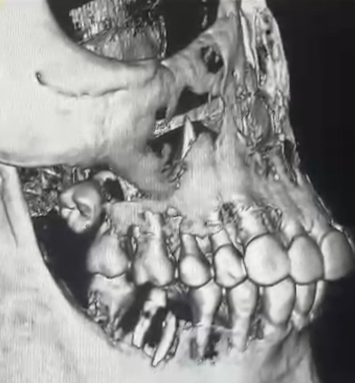 Alicia Araceli Navarro Burguete-11