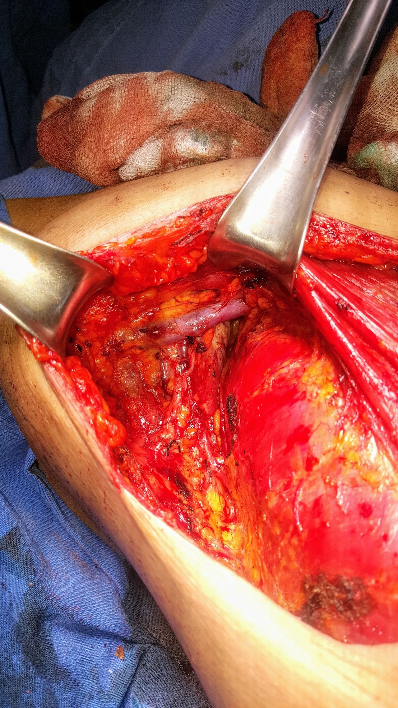 Ángel Millán Juárez-22