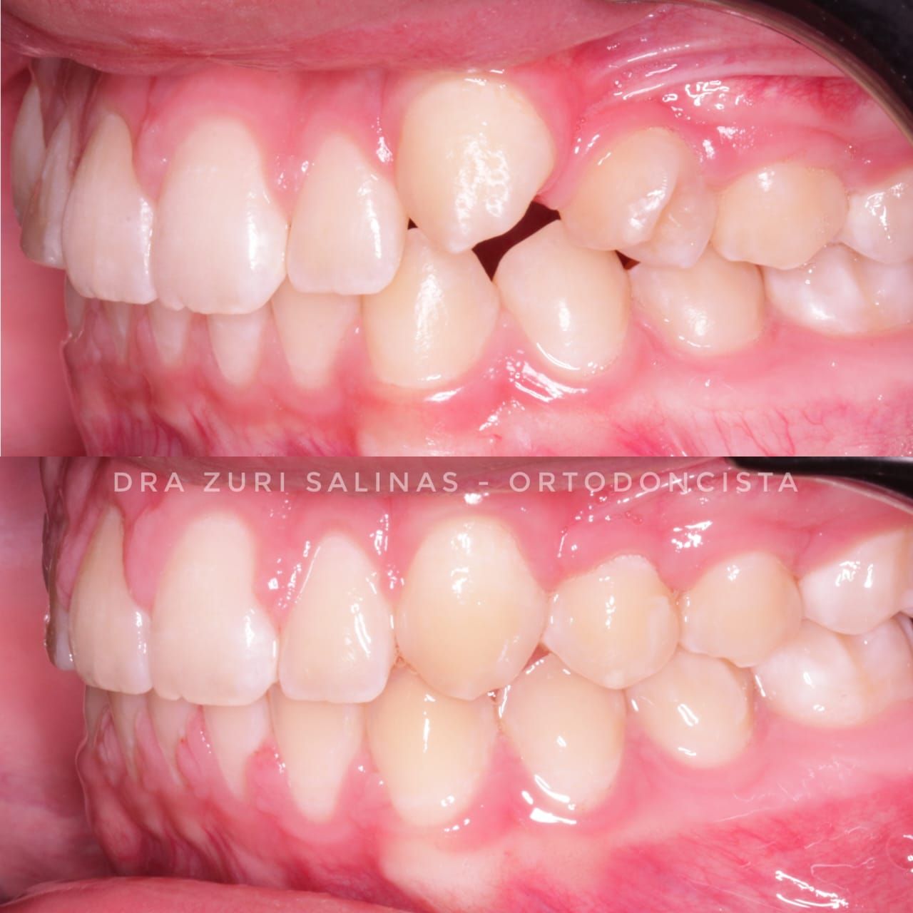 Zurisadai Salinas Chávez-3