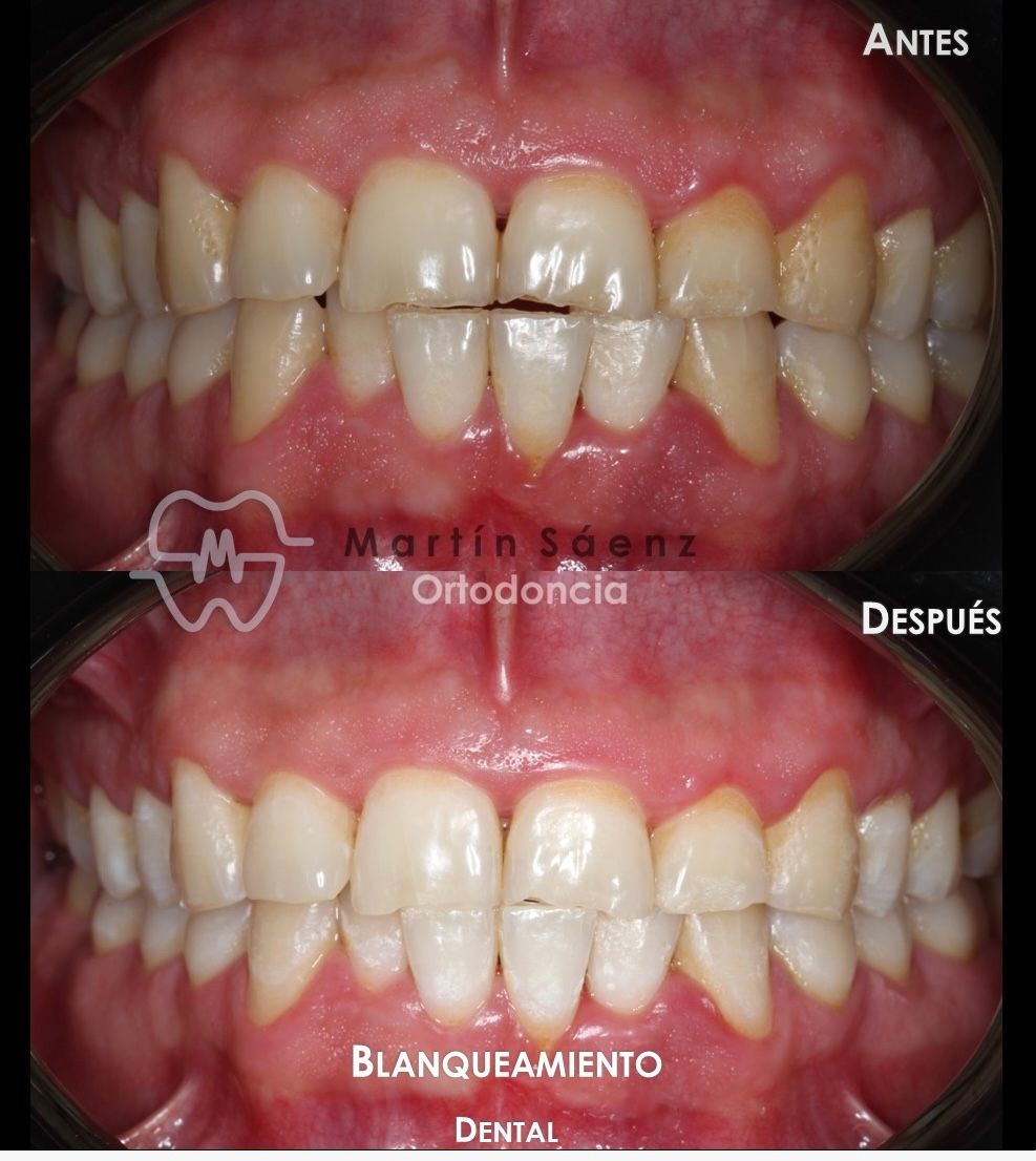 Martín Sáenz Zárate-9