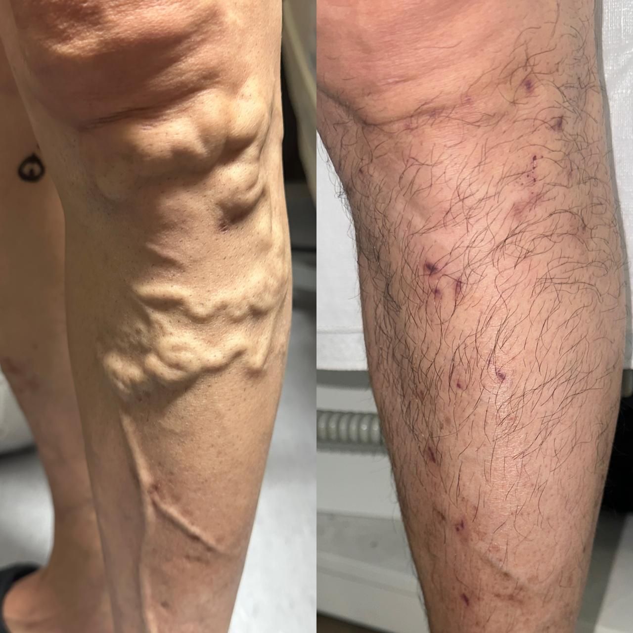 Jhonatan López González-4