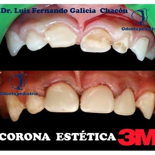 Luis Fernando Galicia Chacón-13