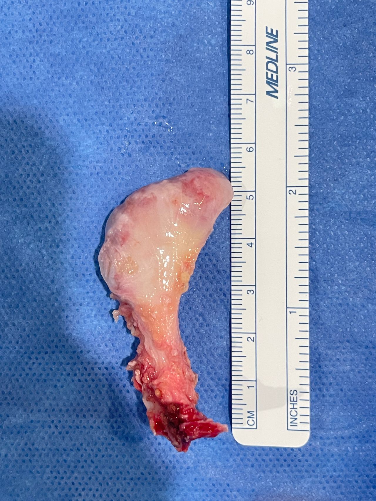 Hernán Lindoro Félix-3