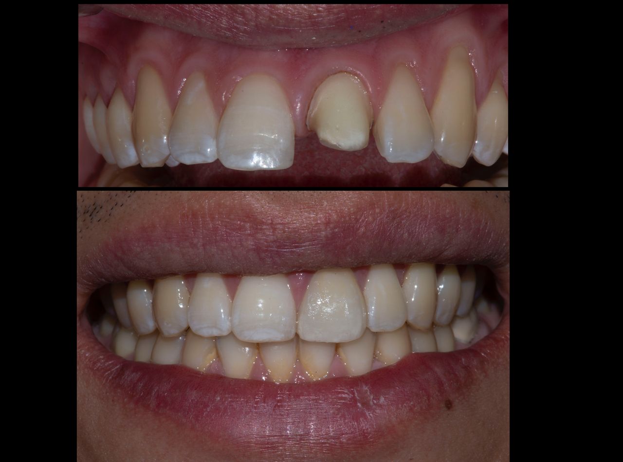 María Fernanda González Gastelum-32