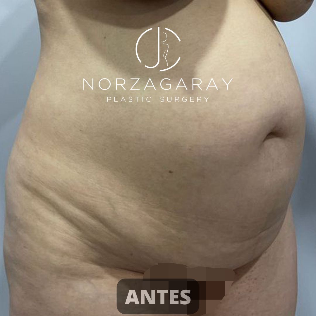 Juan Carlos Norzagaray-7