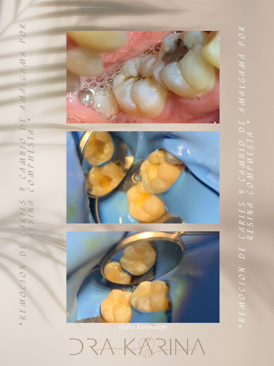 Karina Lepe Pedrajo-3