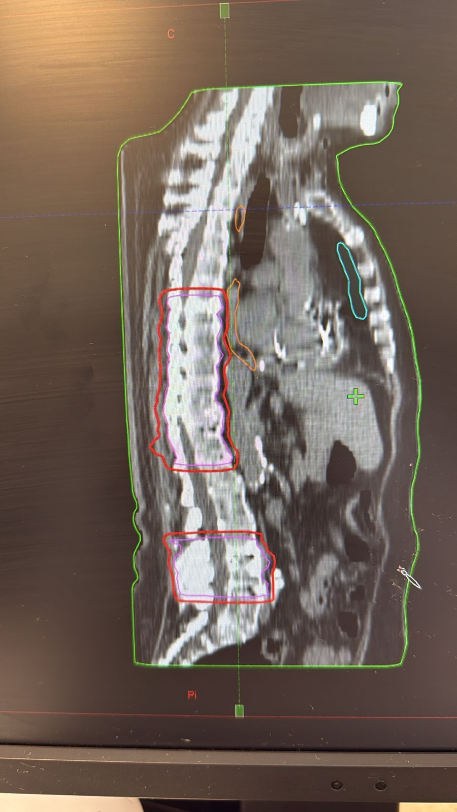 Emmanuel Hernández Bahena-12