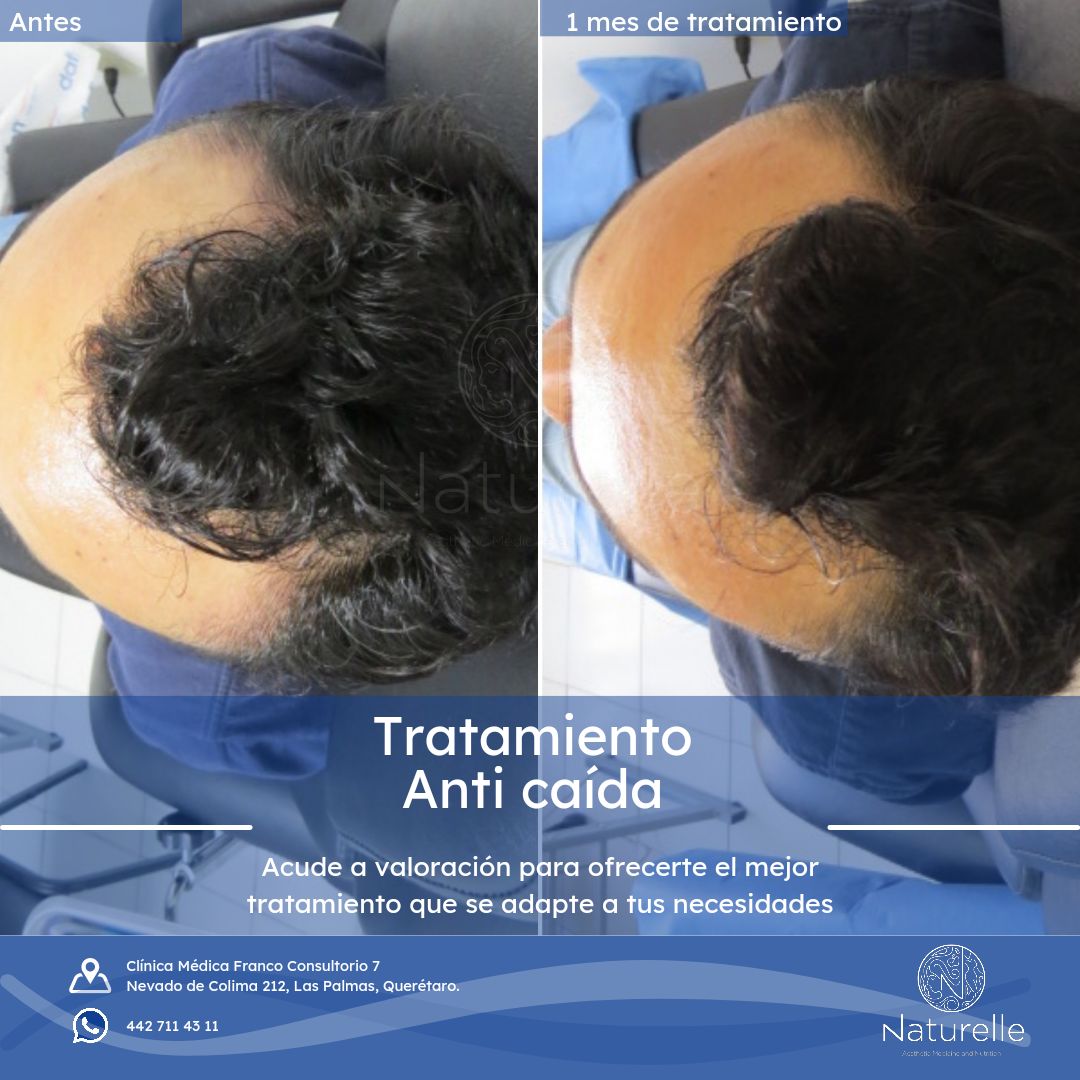 Daniel Marín Jasso-27